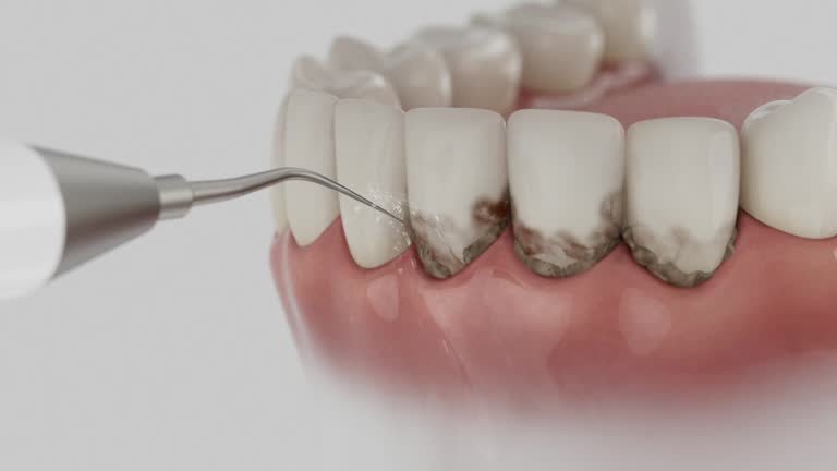 Trusted Tooth Extraction service in Harper, TX - Dentist Open Now